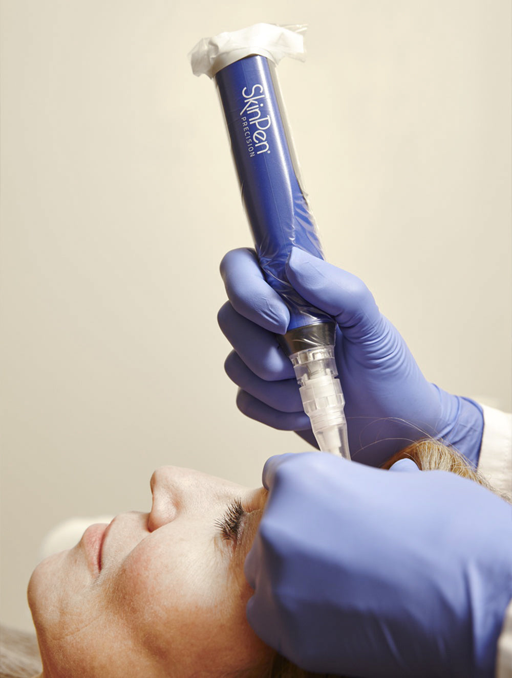 SkinPen Microneedling